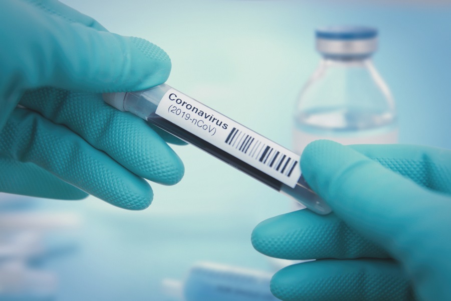 Coronavirus sample in test tube
